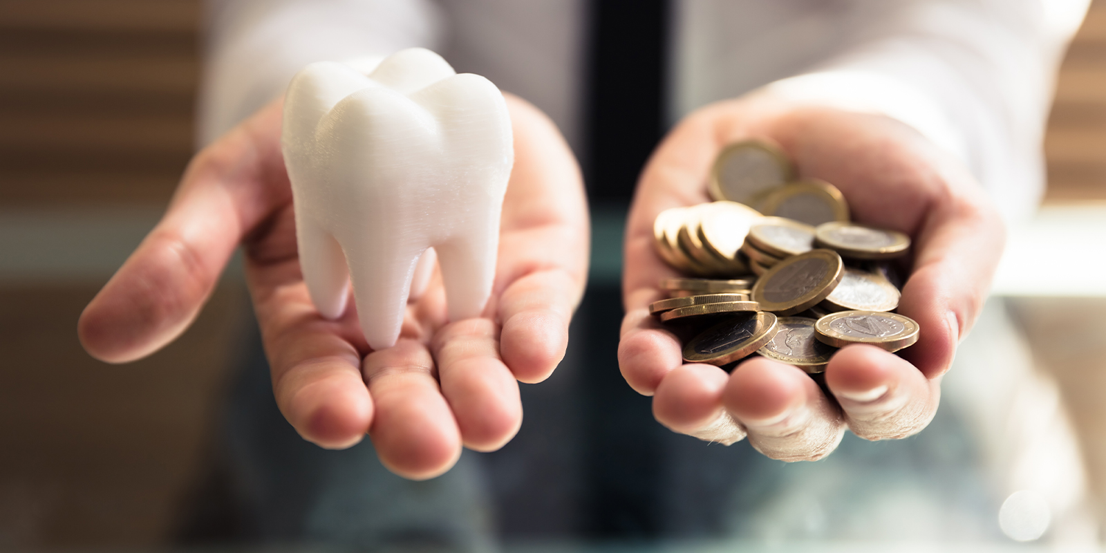 インプラント治療の費用相場（値段・平均価格・金額・料金）と内訳はいくら？